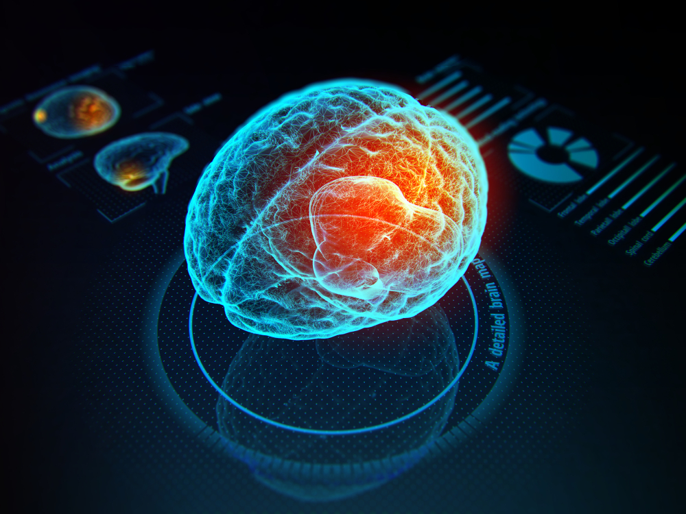 neural scan pro main street medical clinics spring tx huntsville tx Neural Scan Pro, Main Street Medical Clinics, Spring, TX, Huntsville, TX
