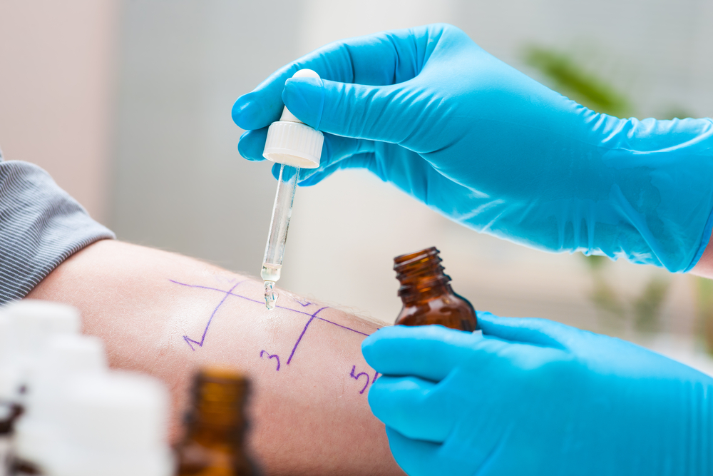 Allergy Tests at MSMC: Identifying Your Allergens