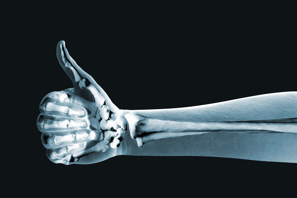 How to Improve Your Bone Health